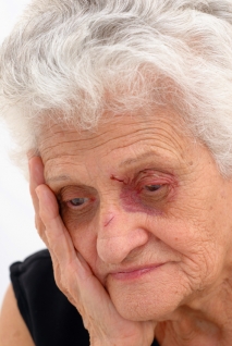 Nursing Home Abuse